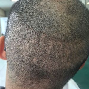 发际线分享社区