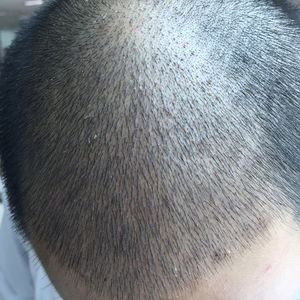 发际线分享社区
