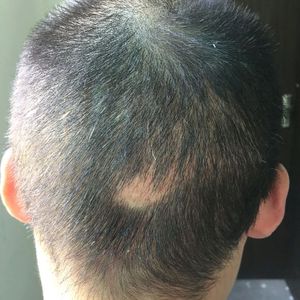 发际线分享社区