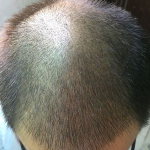 发际线分享社区