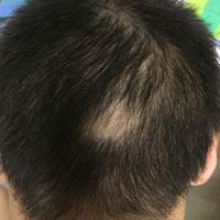 <font color="red">稀少加密</font>用戶圖片