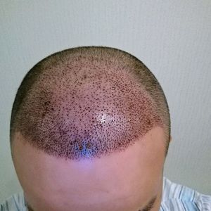 发际线分享社区
