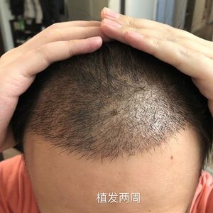 发际线分享社区