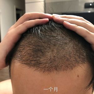 发际线分享社区