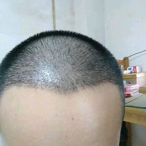 发际线分享社区