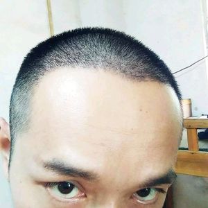 发际线分享社区