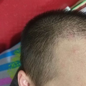 发际线分享社区