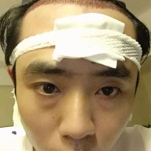 发际线分享社区