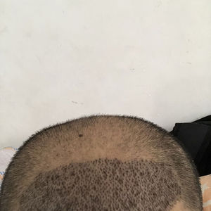 发际线分享社区