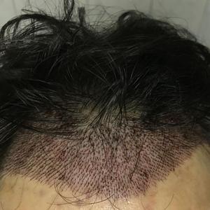 发际线分享社区