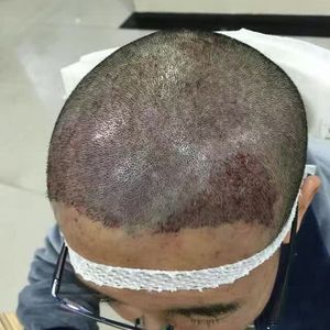 发际线分享社区