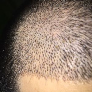 发际线分享社区