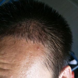 发际线分享社区