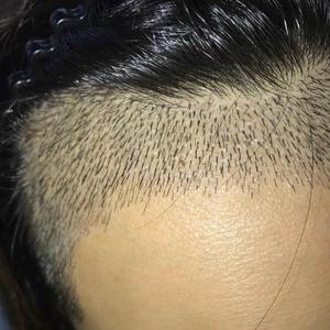 发际线分享社区