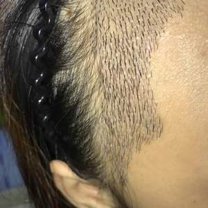发际线分享社区