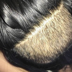 发际线分享社区