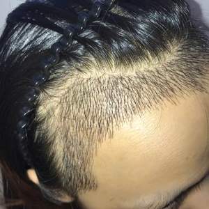 发际线分享社区