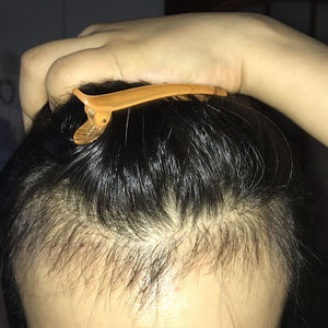 发际线分享社区