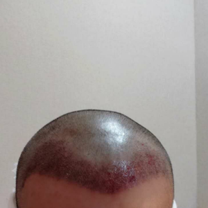 发际线分享社区