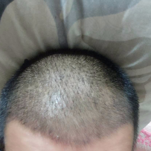 发际线分享社区