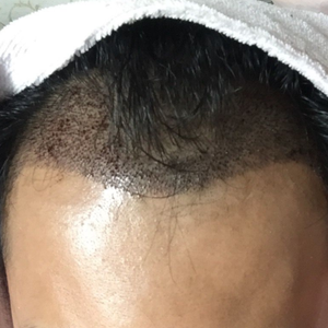 发际线分享社区