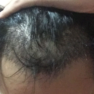 发际线分享社区