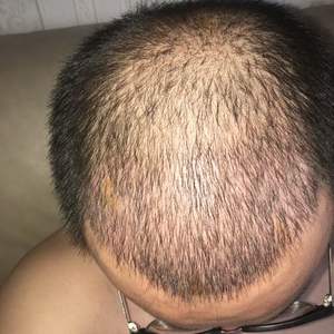 发际线分享社区