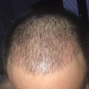 发际线分享社区
