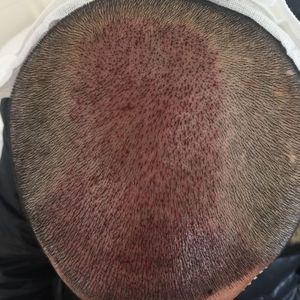 发际线分享社区