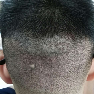 发际线分享社区