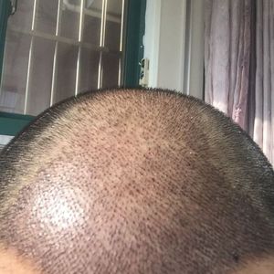 发际线分享社区