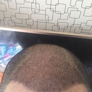 发际线分享社区