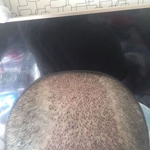 发际线分享社区