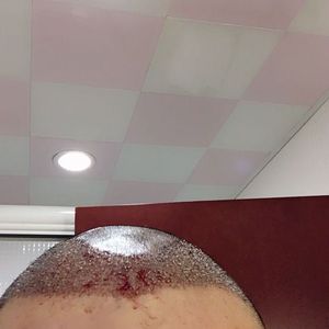 发际线分享社区
