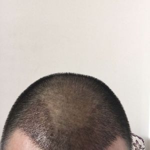 发际线分享社区