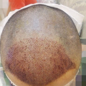 发际线分享社区