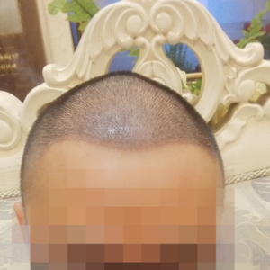 发际线分享社区
