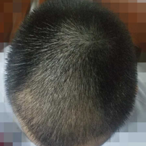 发际线分享社区