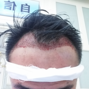 发际线分享社区