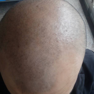 发际线分享社区