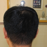 <font color="red">稀少加密</font>用戶圖片