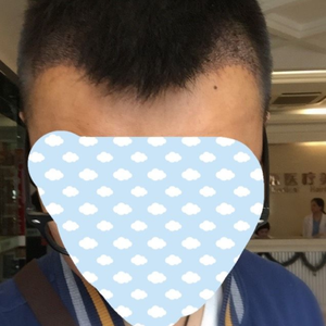 发际线分享社区
