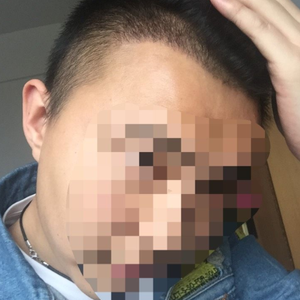 发际线分享社区