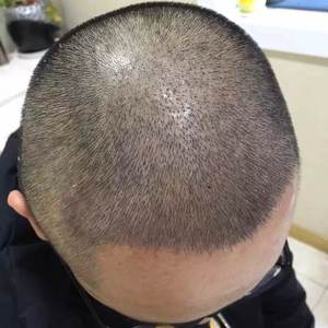 发际线分享社区