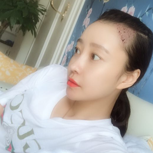 发际线分享社区