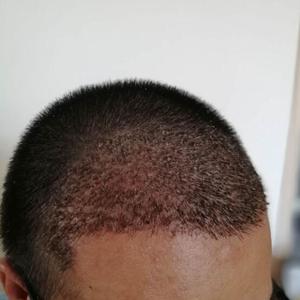发际线分享社区