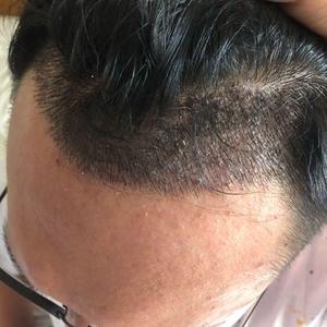 发际线分享社区