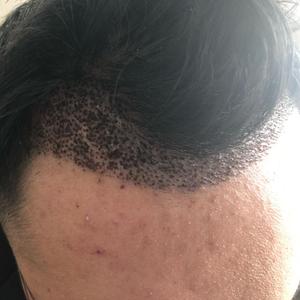 发际线分享社区