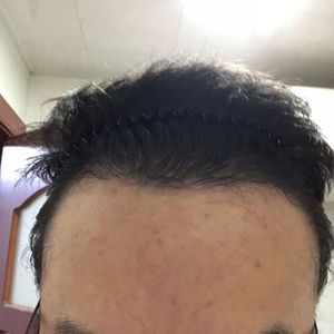 发际线分享社区