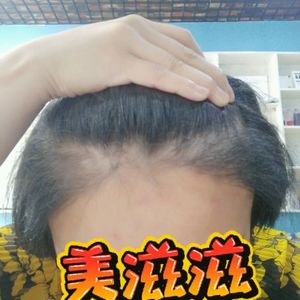 发际线分享社区